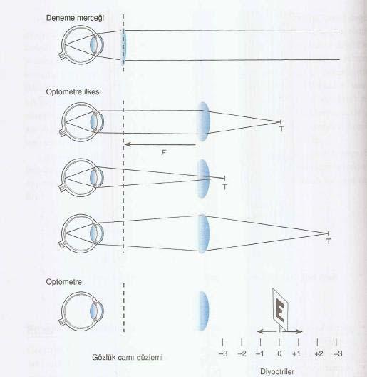 Optometre ilkesi: Değiştirilebilir deneme mercekleri yerine gözlük düzleminden odak uzaklığı mesafesine tek bir yoğunlaştırıcı mercek kullanılır.
