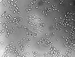 Saccaromyces cerevisiae Bira a ası a da ek ek a ası Saccaromyces oulardii i alttipi, probiotik