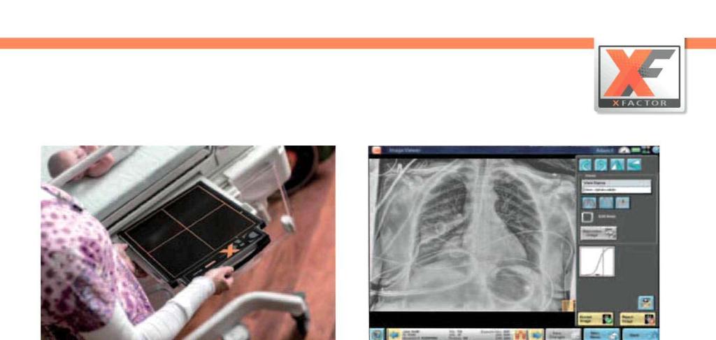 İDEAL GÖRÜNTÜLEME. DRX-Revolution, süper röntgen kalitesi sunan ve kılavuz kullanımını teşvik eden benzersiz bir tüp ve kılavuz hizalama sistemine sahiptir.