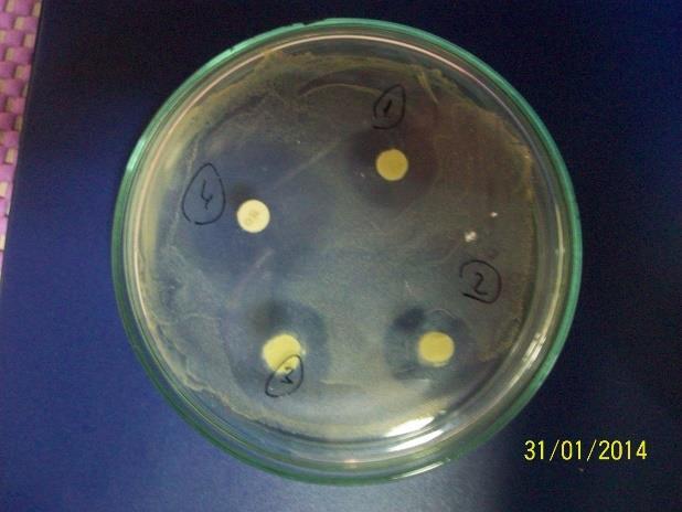 bölge 20 µl özüt 2. bölge 30 µl özüt 3. bölge 50 µl özüt 4. bölge Antibiyotik Petri Kabı 1 20 mm 21 mm 22 mm 31 mm (O30,Oksitetrasiklin) Petri Kabı 2 13 mm 15 mm 17 mm 42 mm (A10, Ampisilin) 4.