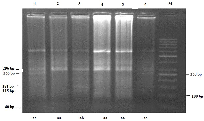 51 4.1.5. DdeI restriksiyon enzimi ile kesim Dde I DRB1 ekson 2 gen bölgesi DdeI restriksiyon enzimi kesim sonuçları Çizelge 4.1 de verilmiştir. DdeI kesim profili Konnai ve ark.