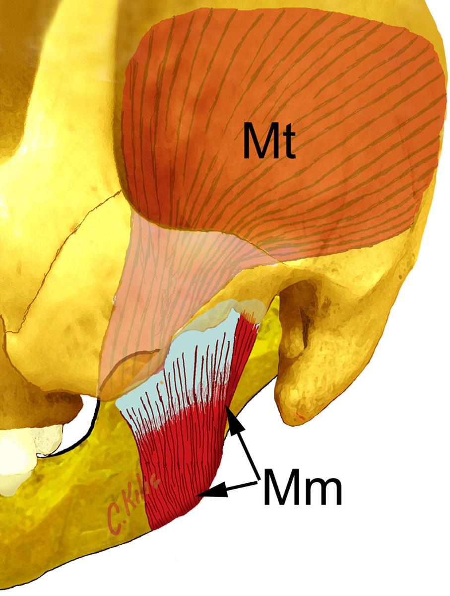 Şekil 12. Musculus masseter (Mm), ve musculus temporalis (Mt). Musculus Pterygoideus Lateralis Üçgen şeklindedir ve kalındır. Üst ve alt olmak üzere iki başı vardır.