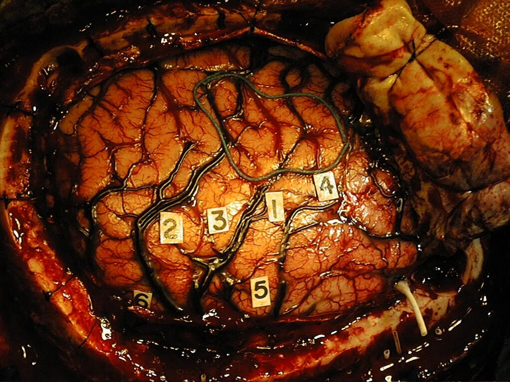 Beyin kabuğu (korteks): Algılama: İşitme, görme, koku, kaslar ve iç organlardan