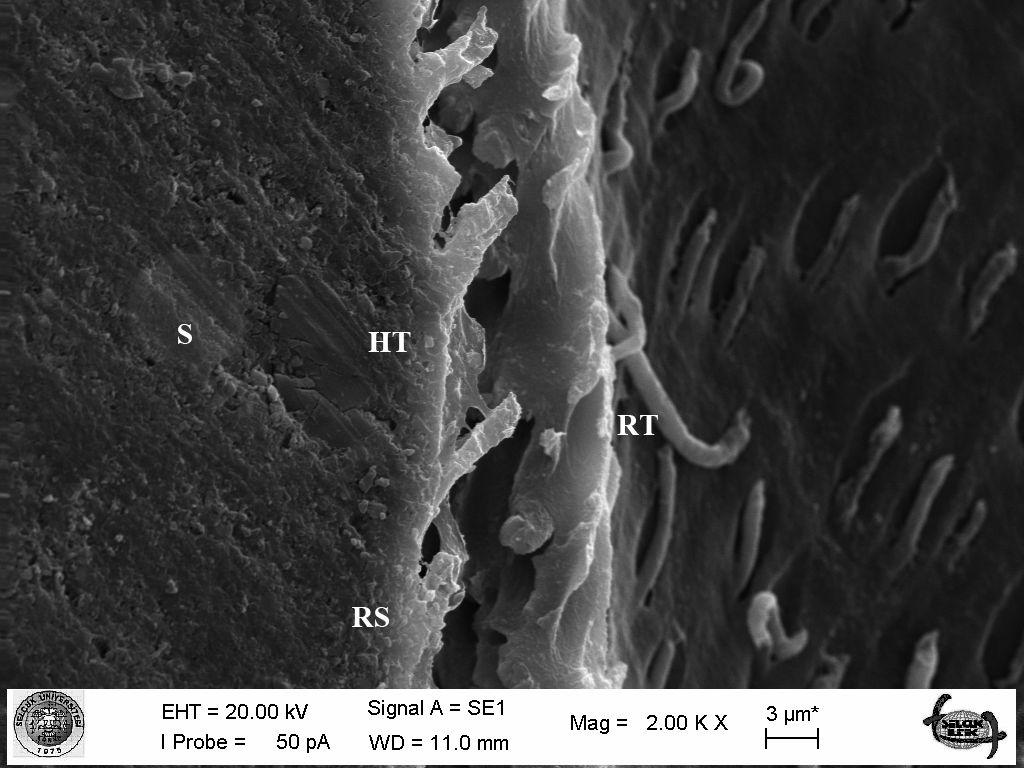 500 büyütme). (S: Seramik, RS: Rezin Siman, HT: Hibrit Tabaka, RT: Rezin Tag) 4.