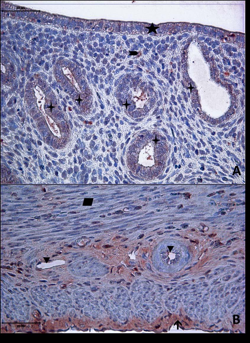 Resim 1A,B: Gebe ve diyabeti olmayan genç gruba ait uterus dokusunda, Tip3 kollajen boyamasında, epitel, bez