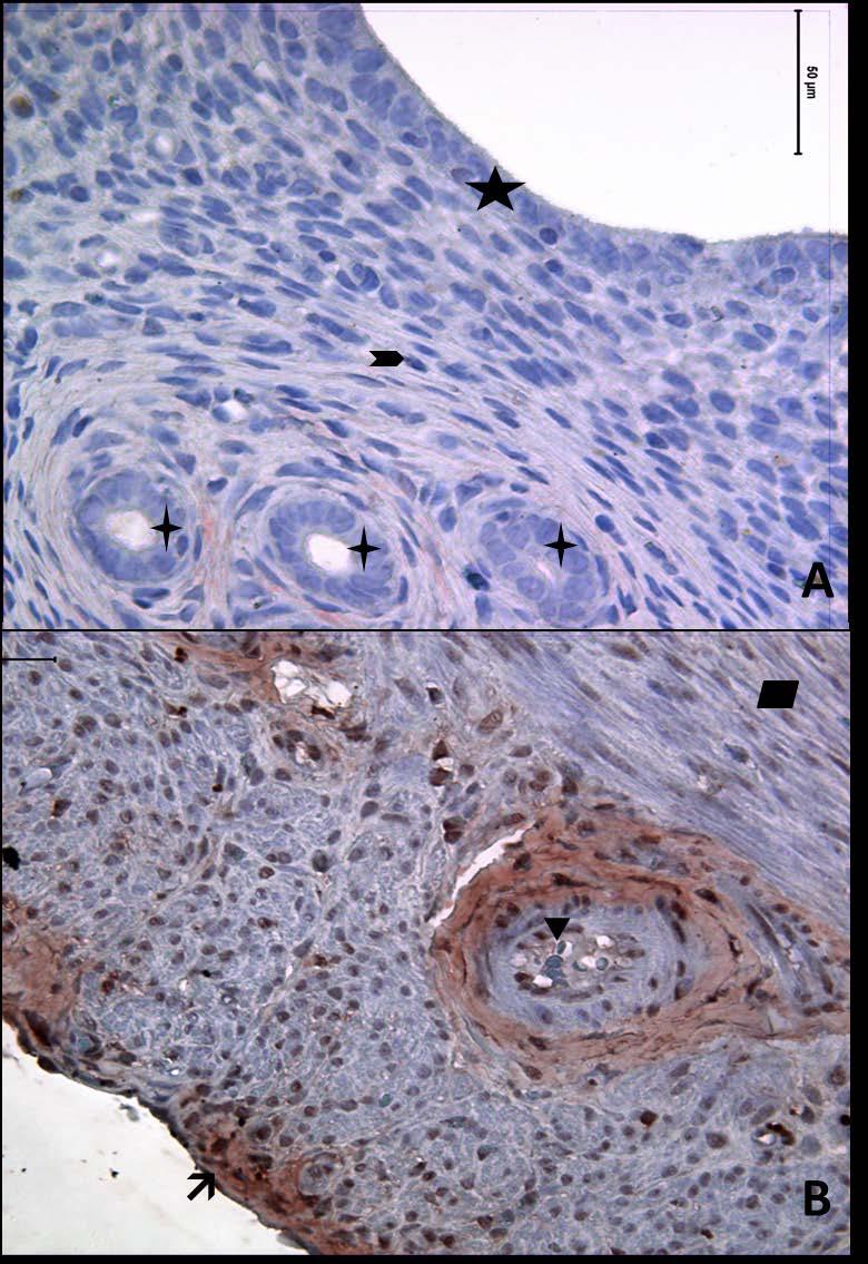 Resim 2A,B: Gebe olmayan, diyabetli ve genç gruba ait uterus dokusunda, tip3 kollajen boyamasında epitel, bez