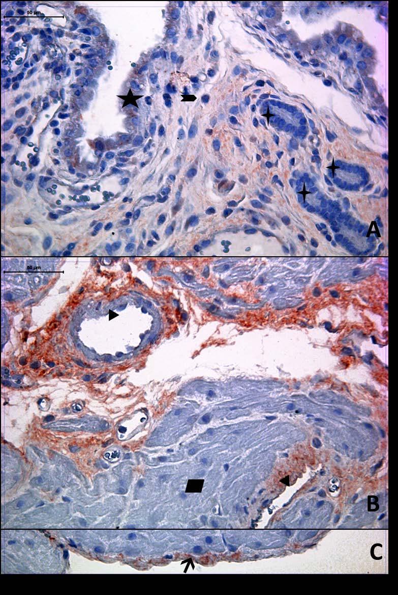 Resim 3A,B: Gebe, diyabet olmayan genç gruba ait uterus dokusunda tip3 kollajen boyamasında epitel, bez