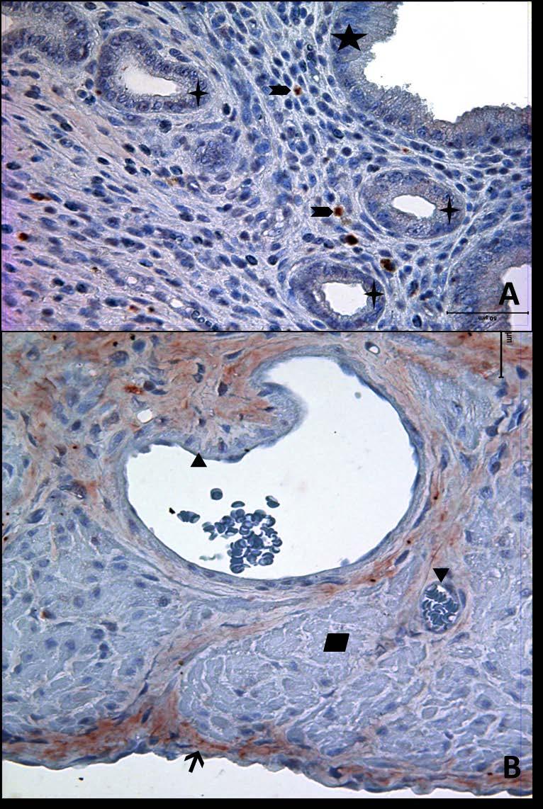Resim 4A,B: Gebe, diyabetli ve genç gruba ait uterus dokusunda tip3 kollajen boyamasında epitel, bez