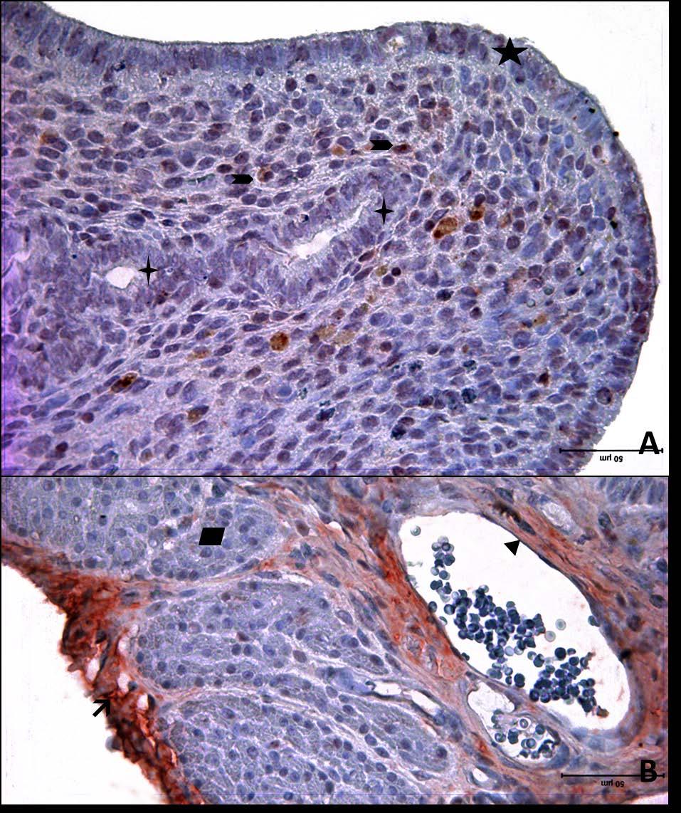 Resim 5A,B: Gebe ve diyabeti olmayan yaşlı gruba ait uterus dokusunda, tip3 kollajen boyamasında epitel, bez