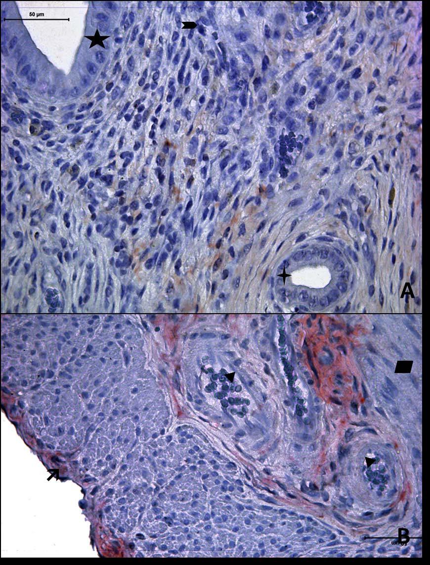 Resim 6A,B: Gebe olmayan, diyabetli ve yaşlı gruba ait uterus dokusunda tip3 kollajen boyamasında epitel, bez