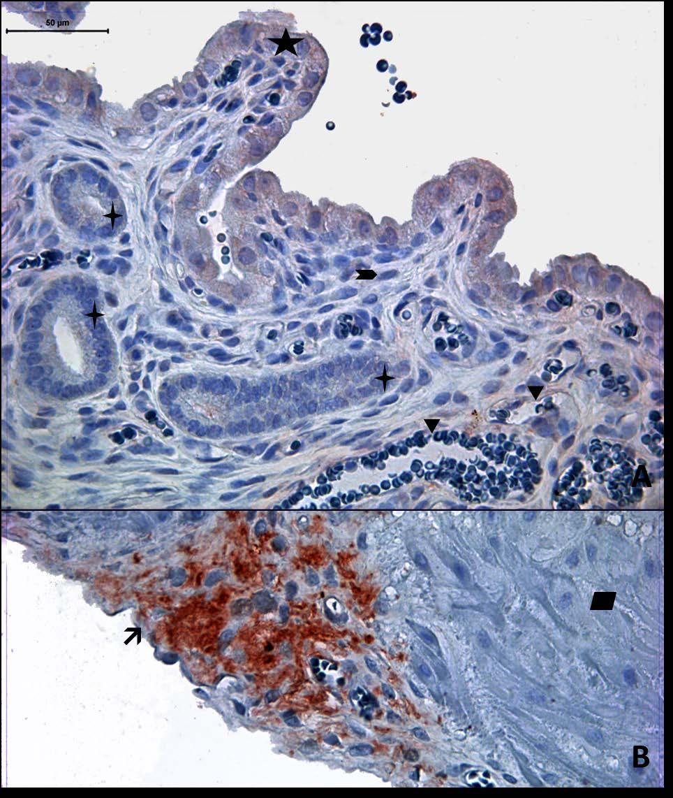 Resim 7A,B: Gebe, diyabeti olmayan yaşlı gruba ait uterus dokusunda tip3 kollajen boyamasında epitel, bez