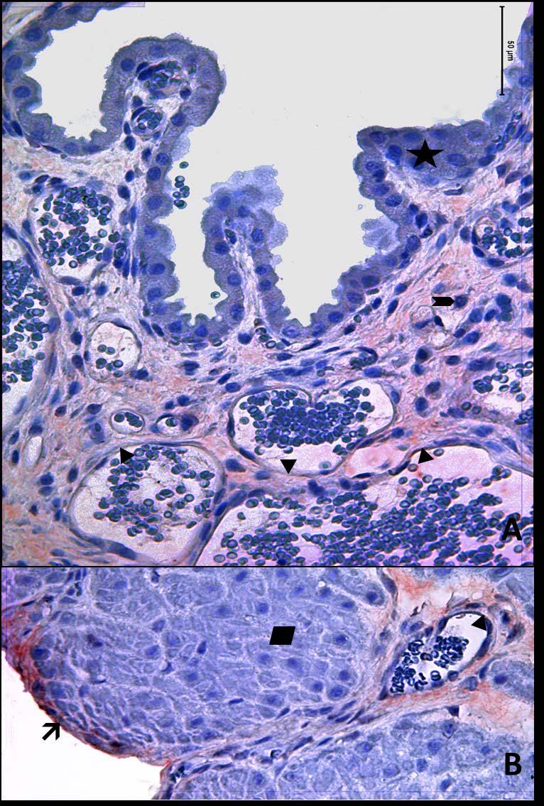 Resim 8A,B: Gebe, diyabetli ve yaşlı gruba ait uterus dokusunda tip3 kollajen boyamasında epitel, bez epiteli,