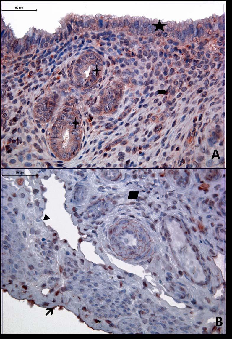 Resim 9A,B: Gebe ve diyabeti olmayan genç gruba ait uterus dokusunda, tip4 kollajen boyamasında epitel, bez