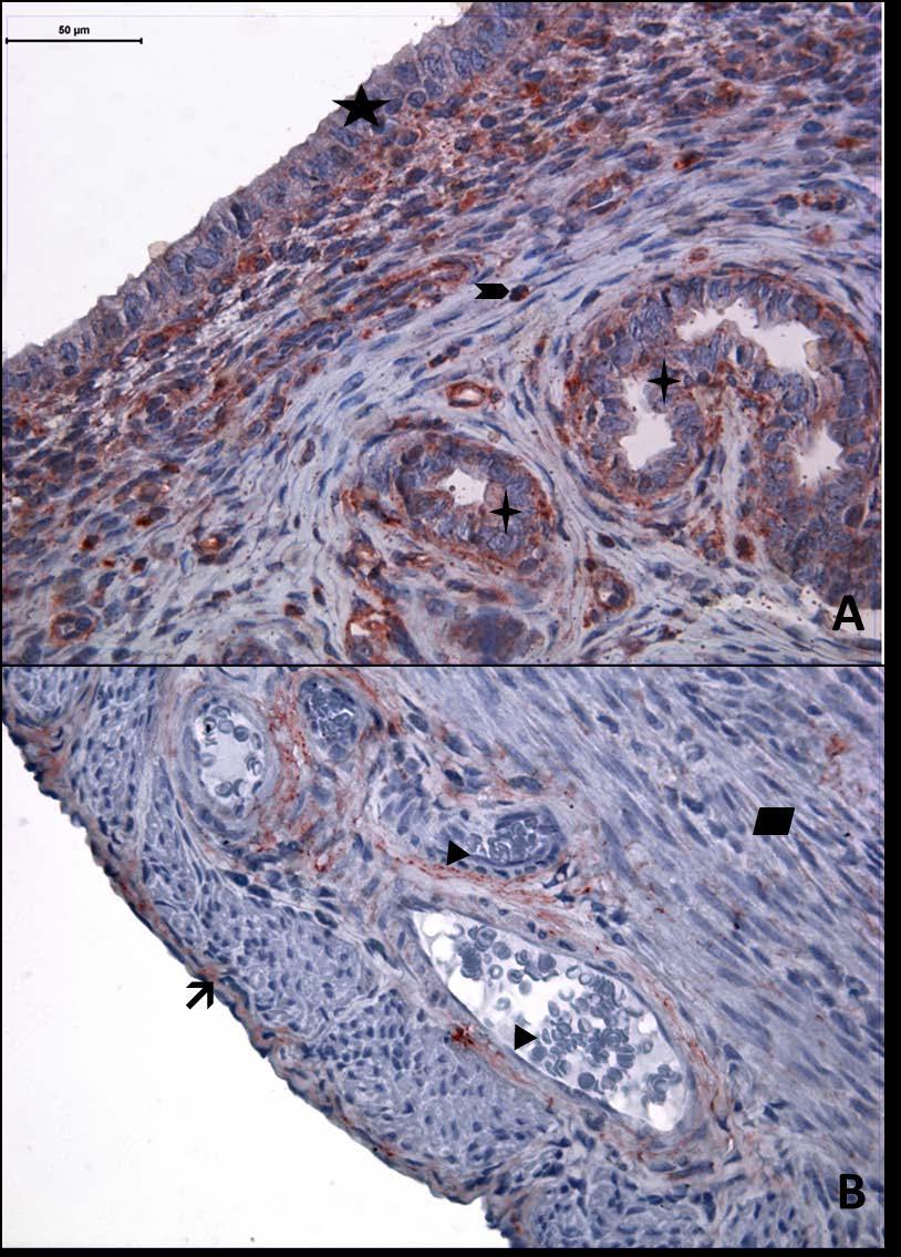 Resim 10A,B: Gebe olmayan, diyabetli ve genç gruba ait uterus dokusunda, tip4 kollajen boyamasında epitel, bez