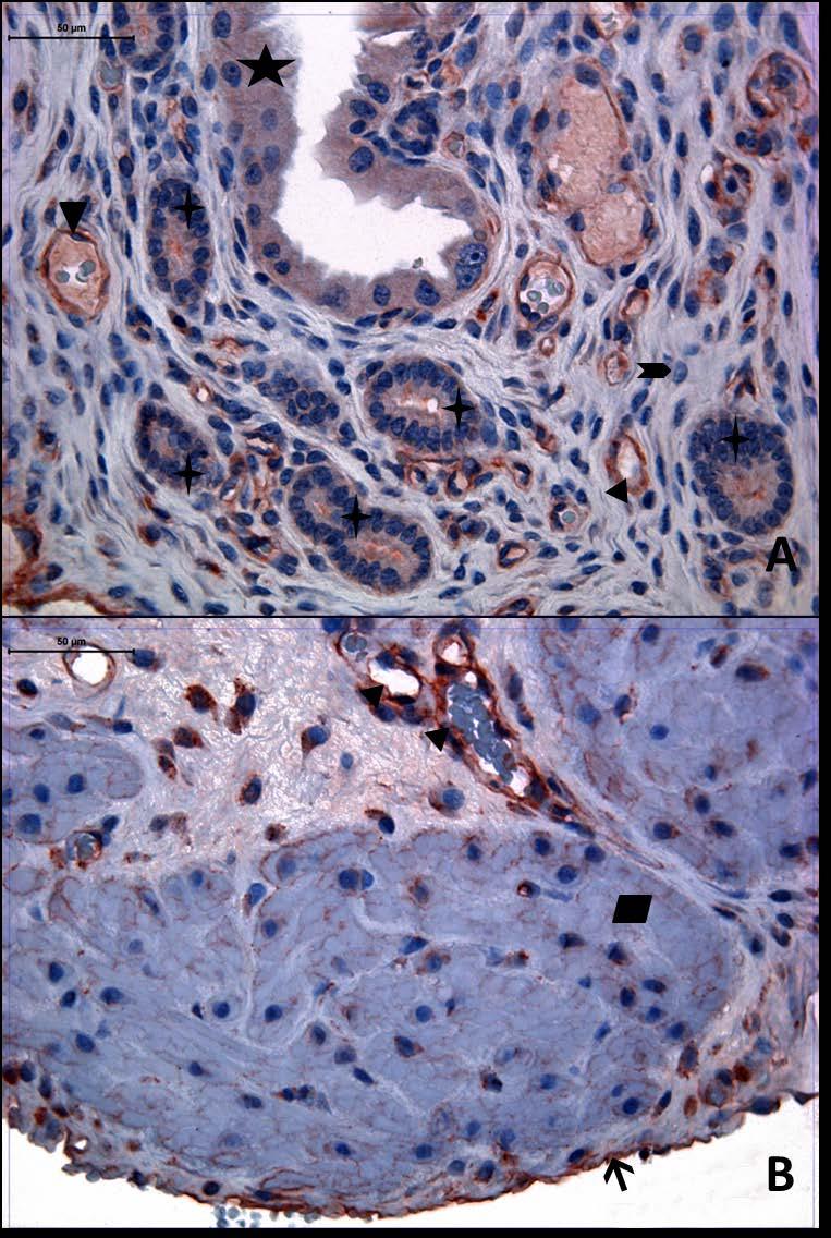Resim 11A,B: Gebe, diyabet olmayan genç gruba ait uterus dokusunda tip4 kollajen boyamasında epitel, bez