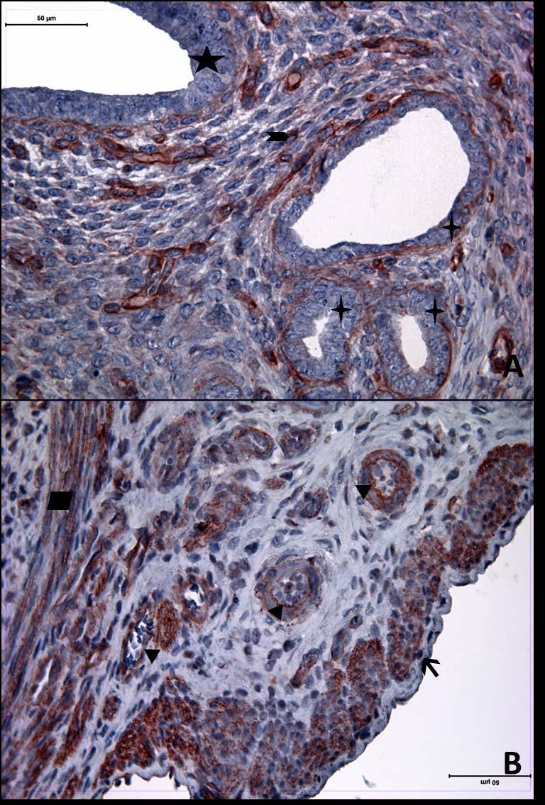 Resim 13A,B: Gebe ve diyabeti olmayan yaşlı gruba ait uterus dokusunda, tip4 kollajen boyamasında epitel, bez