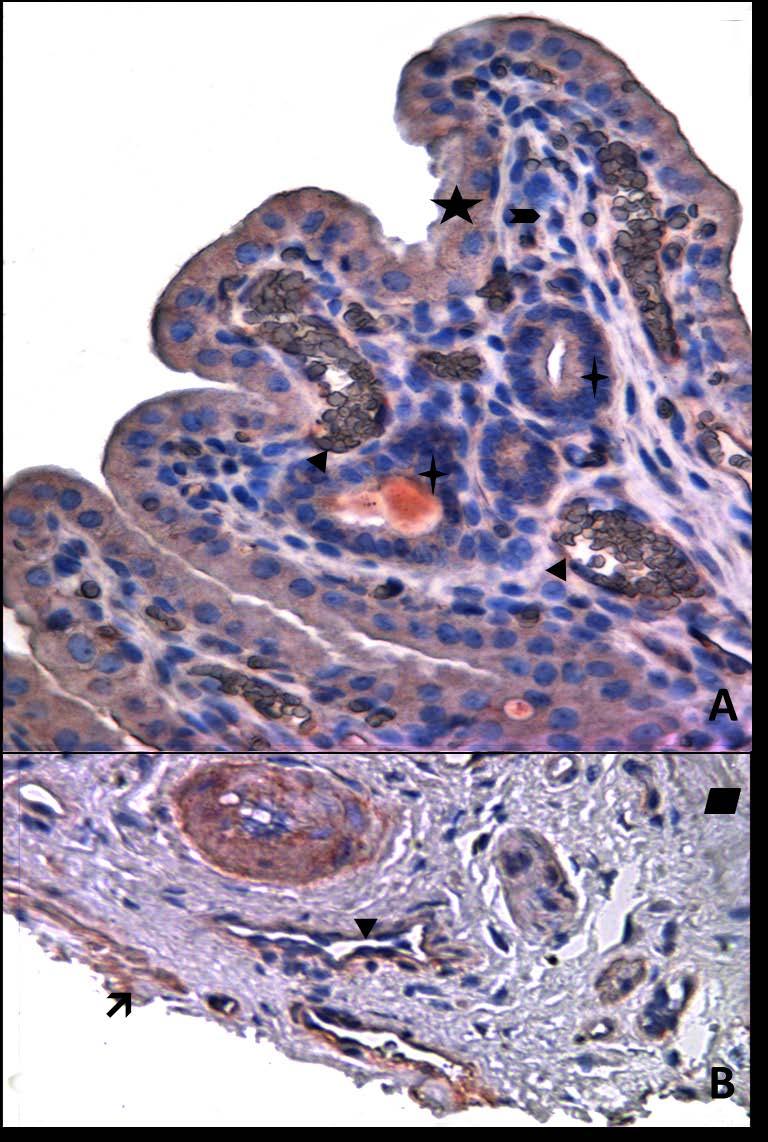 Resim 15A,B: Gebe, diyabeti olmayan yaşlı gruba ait uterus dokusunda tip4 kollajen boyamasında epitel, bez