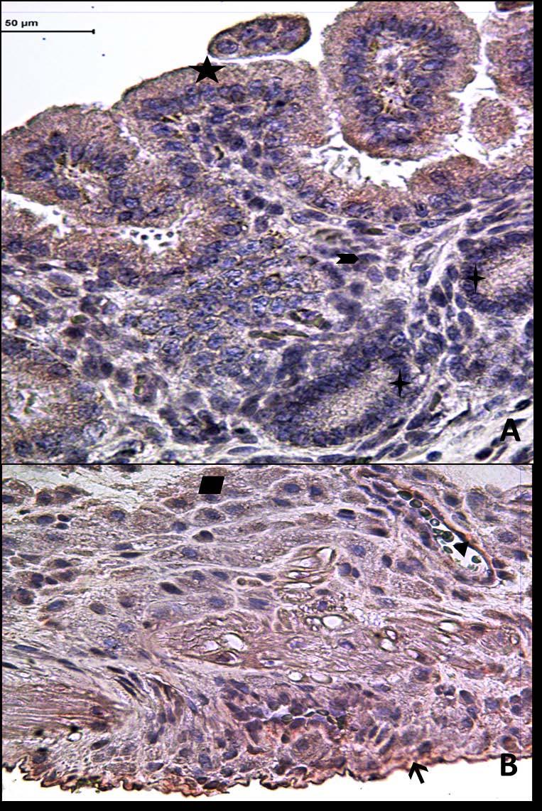 Resim 16A,B: Gebe, diyabetli ve yaşlı gruba ait uterus dokusunda tip4 kollajen boyamasında epitel, bez
