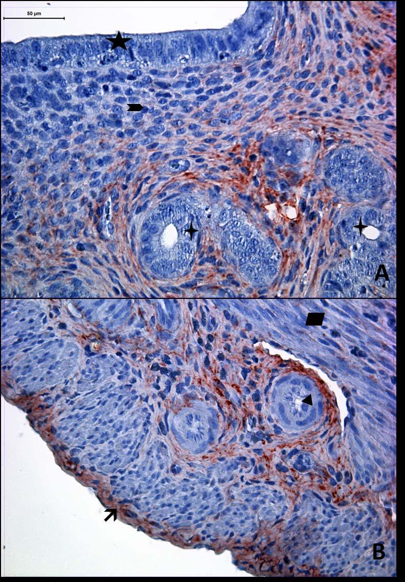 Resim 17A,B: Gebe ve diyabeti olmayan genç gruba ait uterus dokusunda, tip6 kollajen boyamasında epitel, bez
