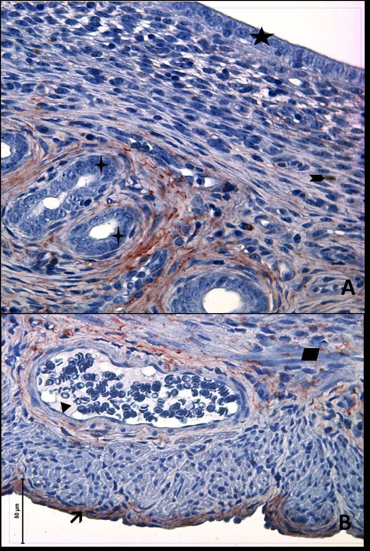 Resim 18A,B: Gebe olmayan, diyabetli ve genç gruba ait uterus dokusunda, tip6 kollajen boyamasında epitel, bez