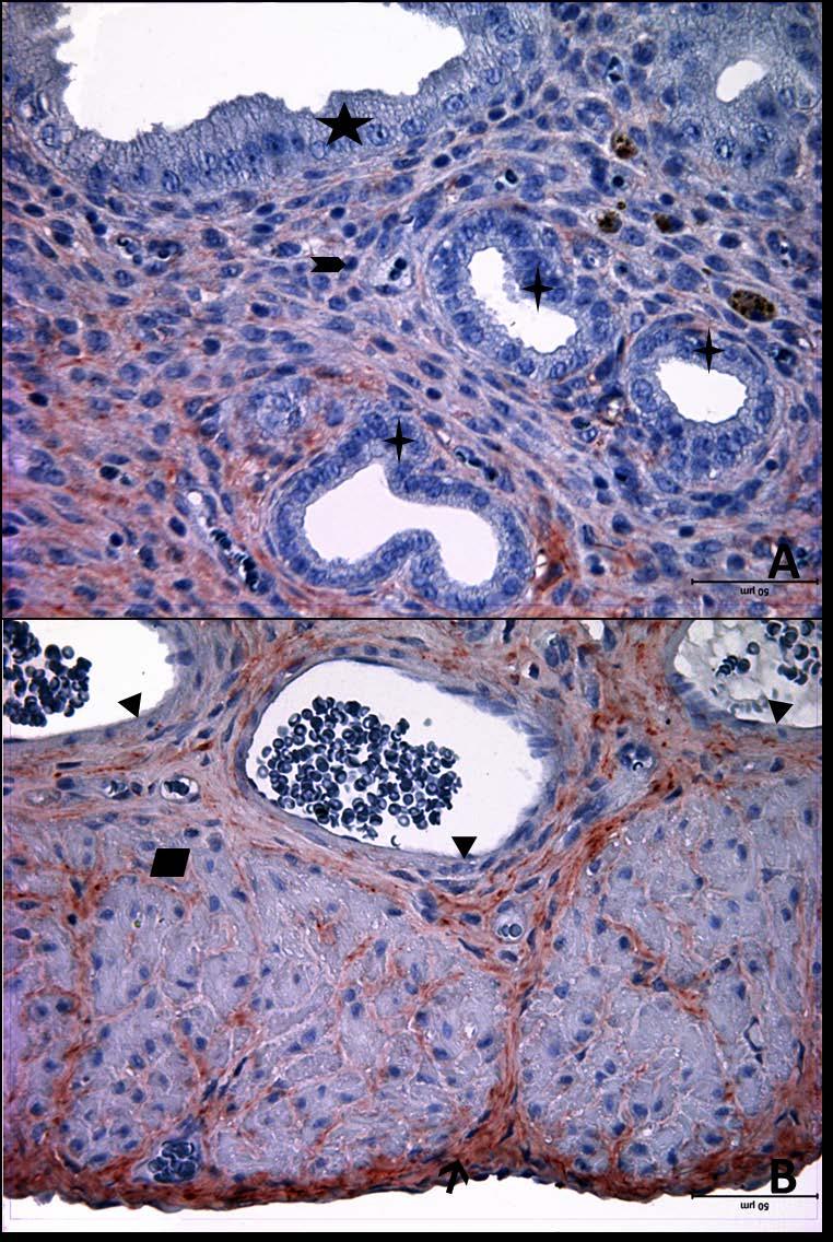 Resim 20A,B: Gebe, diyabetli ve genç gruba ait uterus dokusunda tip6 kollajen boyamasında epitel, bez epiteli,