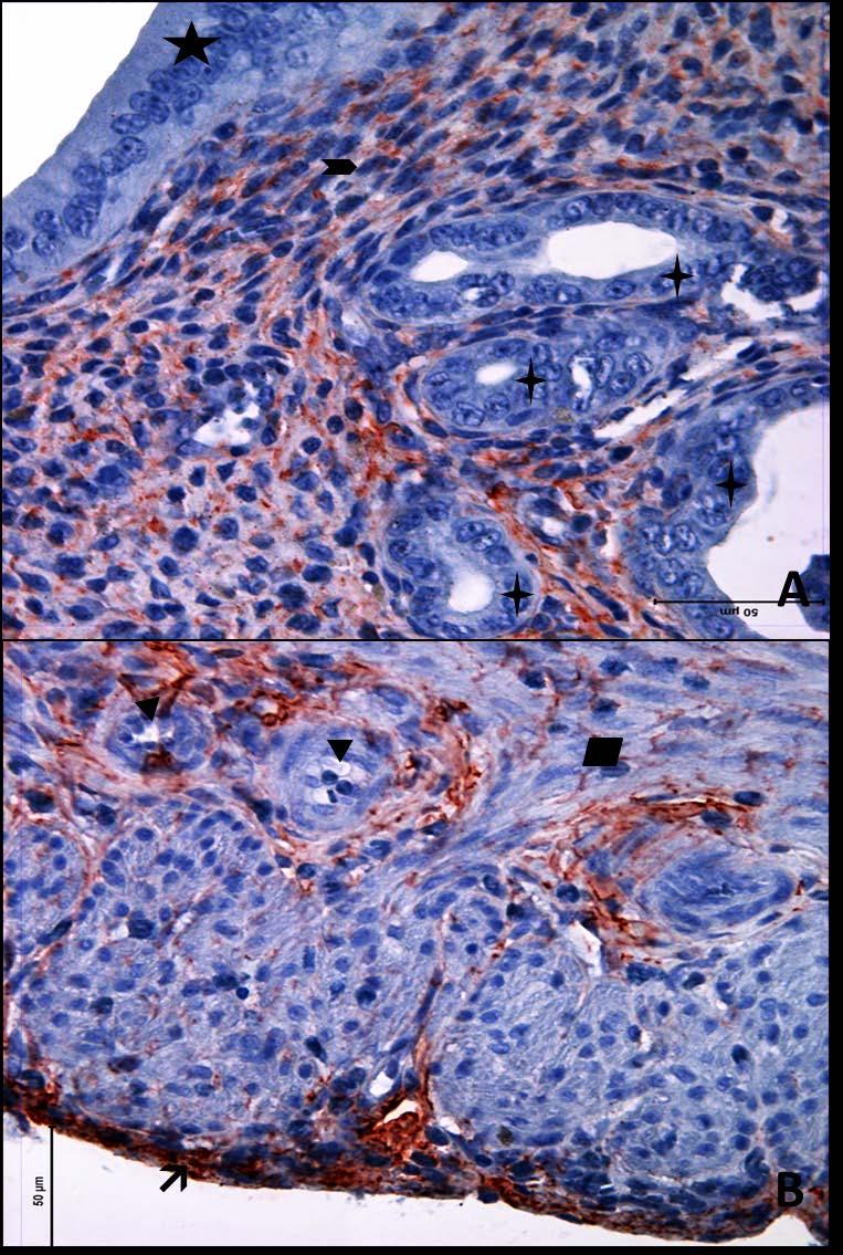 Resim 21A,B: Gebe ve diyabeti olmayan yaşlı gruba ait uterus dokusunda, tip6 kollajen boyamasında epitel, bez