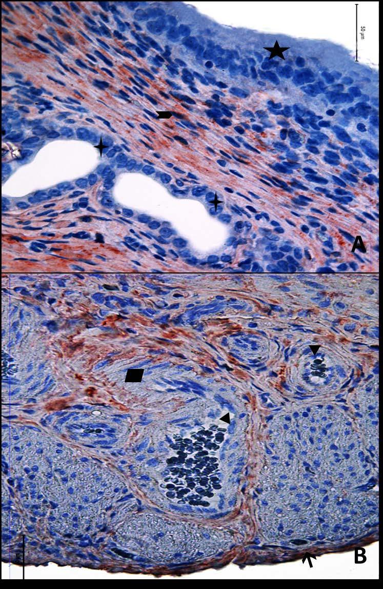 Resim 22A,B: Gebe olmayan, diyabetli ve yaşlı gruba ait uterus dokusunda tip6 kollajen boyamasında epitel, bez