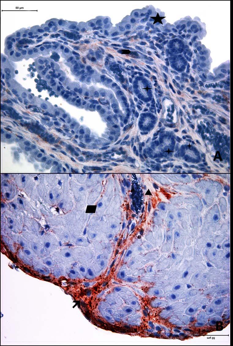 Resim 23A,B: Gebe, diyabeti olmayan yaşlı gruba ait uterus dokusunda tip6 kollajen boyamasında epitel, bez