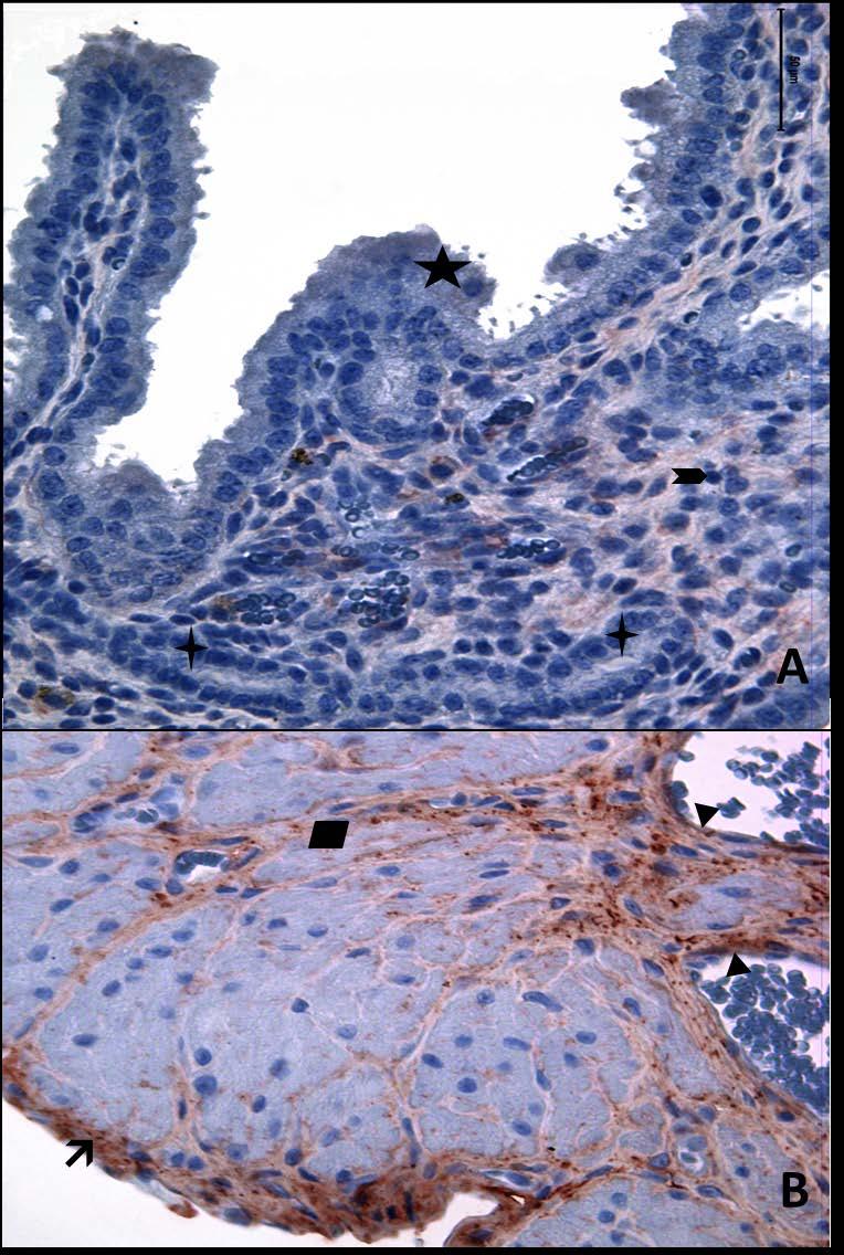 Resim 24A,B: Gebe, diyabetli ve yaşlı gruba ait uterus dokusunda tip6 kollajen boyamasında epitel, bez