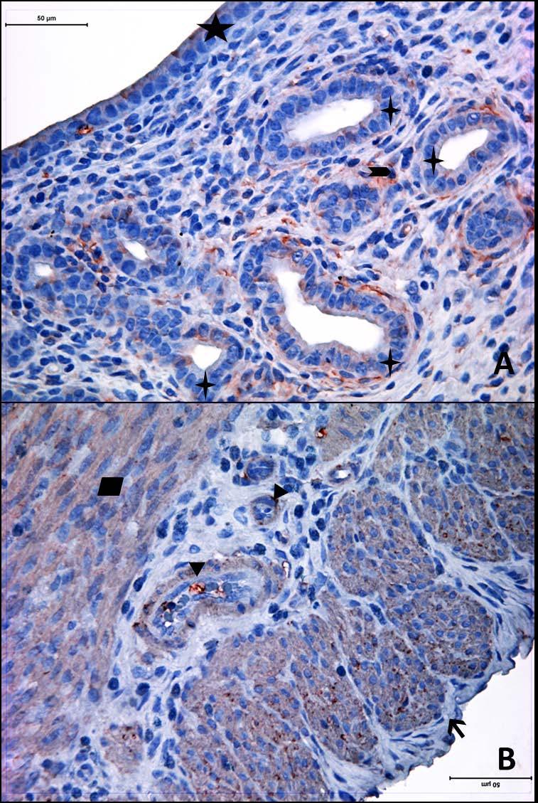 Resim 25A,B: Gebe ve diyabeti olmayan genç gruba ait uterus dokusunda, alfa aktin boyamasında epitel, bez