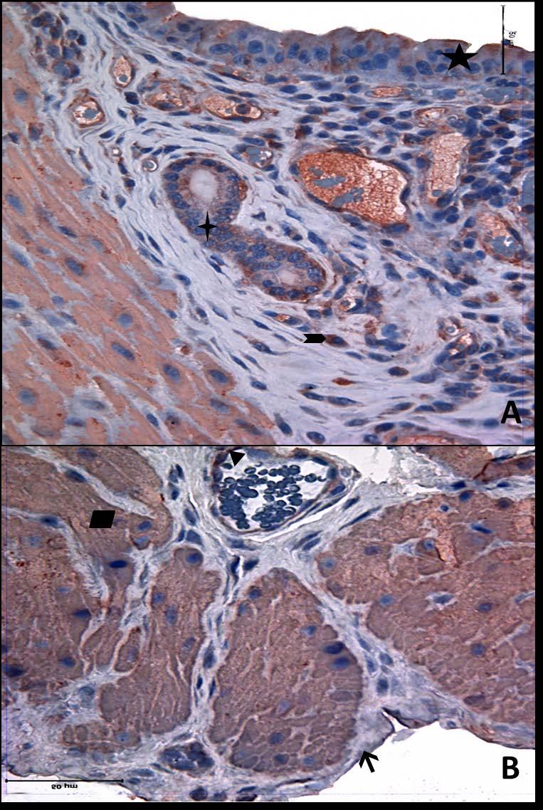 Resim 27A,B: Gebe, diyabet olmayan genç gruba ait uterus dokusunda alfa aktin boyamasında epitel, bez