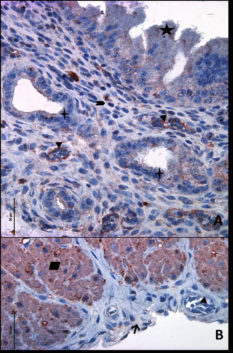 Resim 28A,B: Gebe, diyabetli ve genç gruba ait uterus dokusunda alfa aktin boyamasında epitel, bez