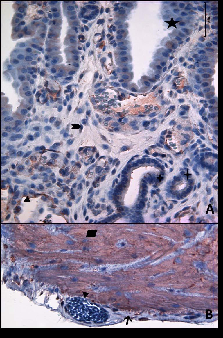 Resim 31A,B: Gebe, diyabeti olmayan yaşlı gruba ait uterus dokusunda alfa aktin boyamasında epitel, bez