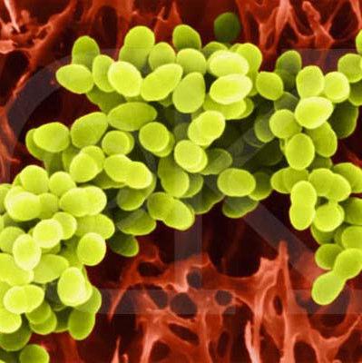 61 Resim 3.2. Staphylococcus aureus un resmi Bacillus subtilis: Sporları çok yaygın olup toz, toprak, gübre, bitki ve hayvanlar ile süt ve sularda bulunan bu bakteri, çomakçık şeklindedir (Resim 3.