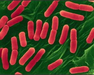 Strepococcus faecalis in resmi Escherichia coli: Enterobacteriaceae familyasindan olan Escherichia coli, çomakçık şeklindedir (Resim 3.5) [37].