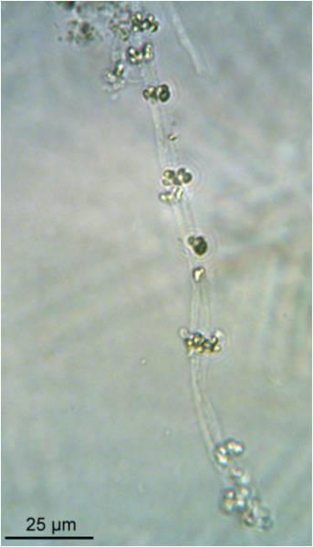 Fitoplankton: Fitoplankton dağılım verileri geçmiş seneler ile kıyaslandığında, ciddi bir tür erozyonundan bahsetmek olasıdır.