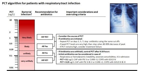 BMC Med 2011 Sep Procalcitonin for diagnosis of infection and guide to
