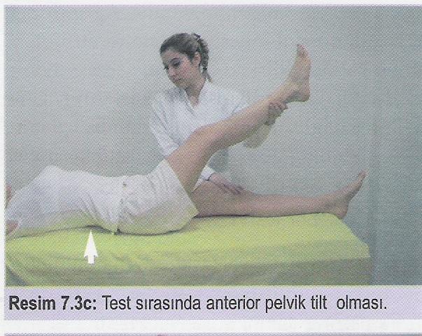 Test sırasında aşırı anterior pelvik tilt olması, hiperekstansiyon durumunda