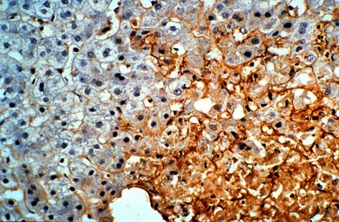 Nekropsi örnekleri de IP ile değerlendirilebilir Immunoperoxidase boyama ile