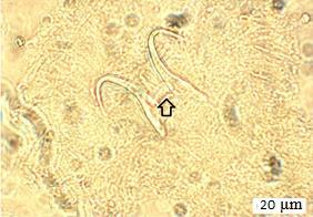 Dar dilsi şekildeki membranın boyu 9-9 µm (9) µm, eni 5-5 (5) µm dir (Şekil 5). Gonadlar vücudun son çeyrek kısımda yer almaktadır. Testis ve ovaryum median konumludur.