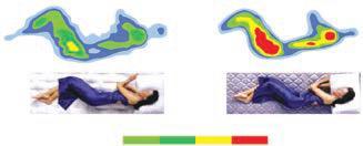 Tıp adamları, en sağlıklı yatış pozisyonunun omurga ve disklere en az yükün bindiği pozisyon olduğunu belirtiyor.
