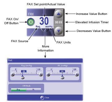 Constellation Vision System Fluid/Air Exchange (FAX) (Sıvı/Hava Değişimi) Genel Kontrolü FAX genel kontrolü, Fluid/Air Exchange (Sıvı/Hava Değişimi) ni açar/kapatır ve ayar noktalarını ayarlar.