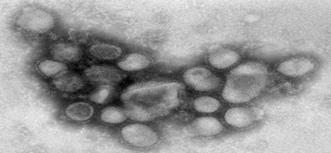 Örnek bir aşının (influenza) hazırlanma aşamaları (Devam) 6) Çeşitli kimyasal ajanlar ile virus parçalara ayrılır, üreme yeteneği tamamen sonlandırılır 7) Prezervatörler ve