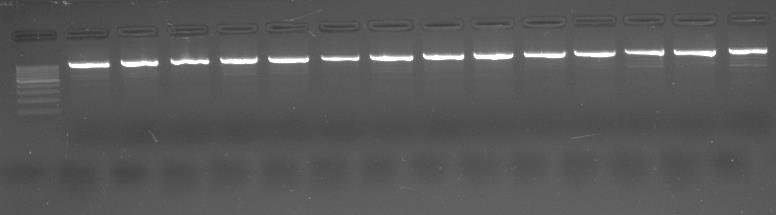 75 İncelenen genlerin PCR sonrası elde edilen örnek elektroforezi ve elektroforegram görüntüleri şekillerde gösterilmiştir (Şekil 3.2, 3.3, 3.4, 3.5, 3.6, 3.7, 3.8, 3.9, 3.10, 3.11, 3.12, 3.13).