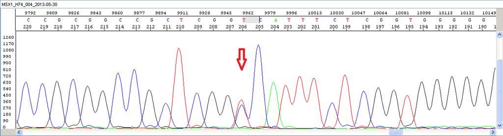 ekzonuna ait PCR sonrası örnek elektroforezi görüntüleri. %2 lik agaroz jel elektroforezi sonrası, etidyum bromür ile boyanmış ve UV görüntüleme sistemi yardımıyla görüntülenmiştir.