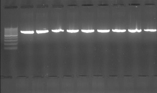 ekzonuna ait PCR sonrası örnek elektroforezi görüntüleri.