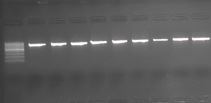 yardımıyla görüntülenmiştir. En sol kulvar 100 bp lik DNA merdivenidir. Şekil 3.7. PAX9 geni 1.