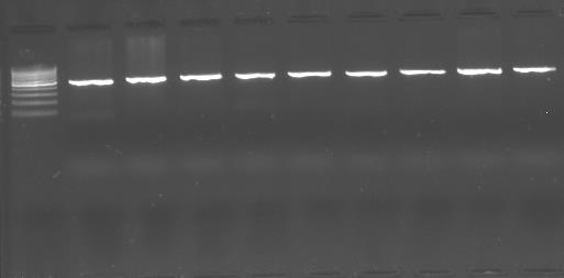 En sol kulvar 100 bp lik DNA merdivenidir. Şekil 3.9. PAX9 geni 3. ekzonuna ait pcr sonrası örnek elektroforezi görüntüleri.