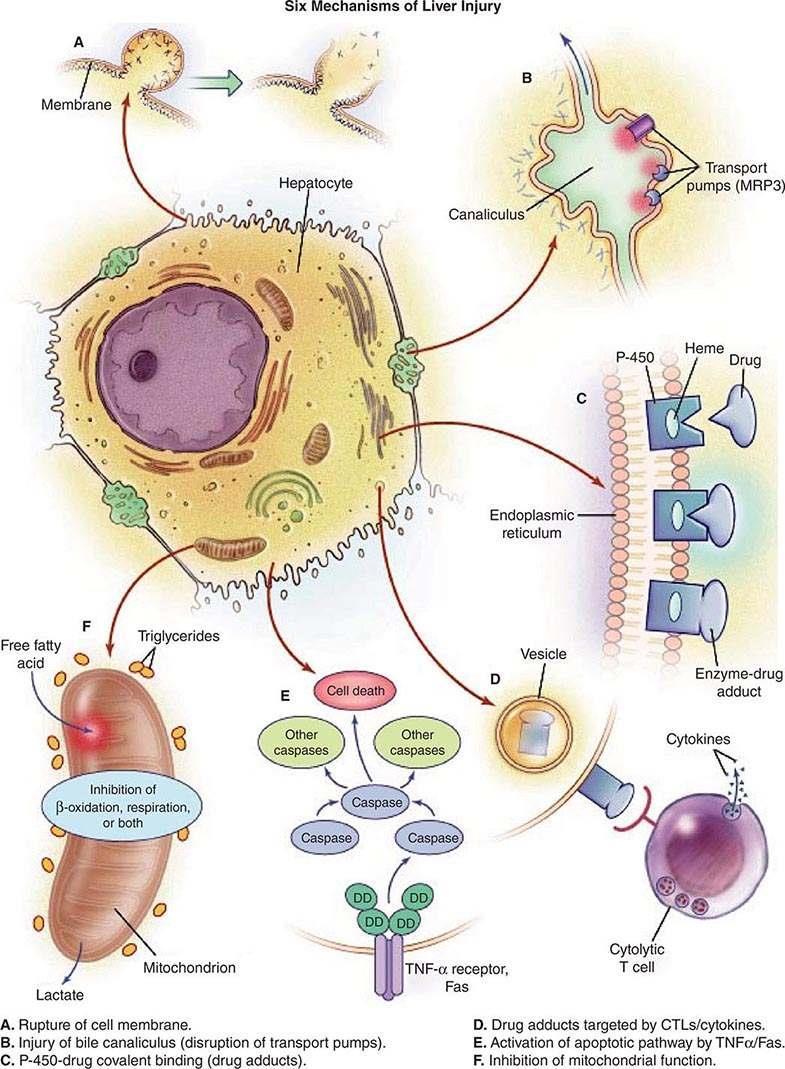Karaciğer Hasarının Mekanizmaları A. Hücre mebranın rüptürü B. Safra kanaliküllerinin hasarı C. P450 enzimine ilaç kovalen bağlanması (drug adduct) D.