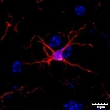 İmmün sistemin hücreleri Myeloid progenitor hücreden nötrofil, eozinofil,bazofil, monositler ve